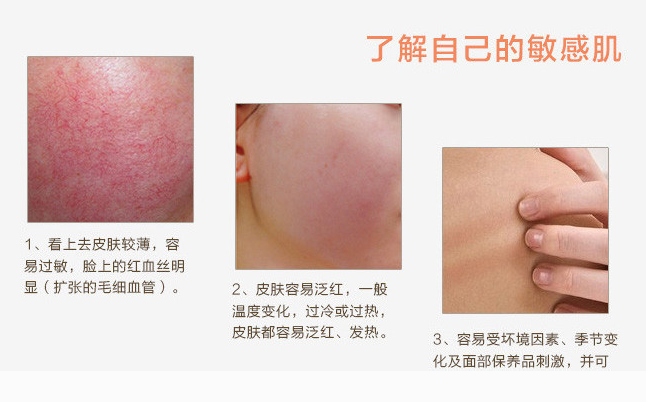 脸部皮肤过敏发红是什么疾病?