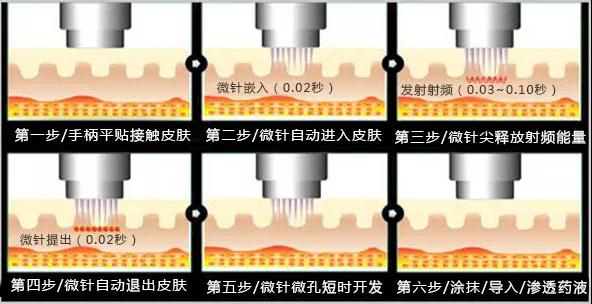 在呼市黄褐斑的临床诊断及疗效标准有哪些？