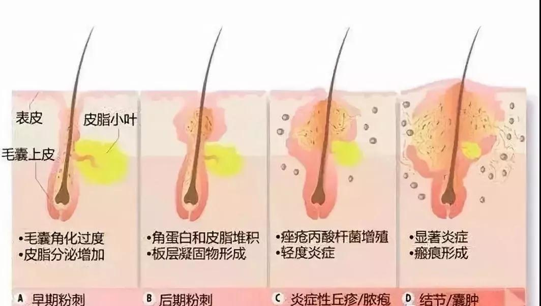 在呼市黄褐斑的临床诊断及疗效标准有哪些？